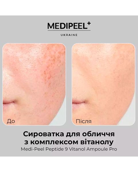 Сироватка антивікова освітлююча з 20% ніацинаміду - Medi-Peel Peptide 9 Vitanol Ampoule Pro 30 мл 437 фото