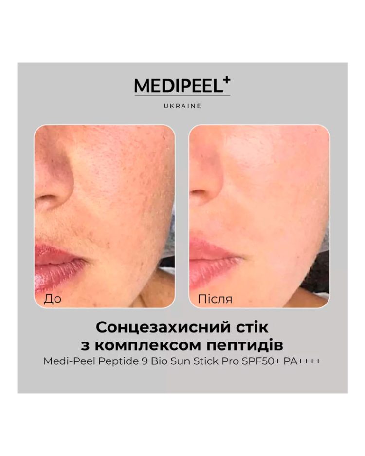 Сонцезахисний стік з пептидами для омолодження і захисту MEDIPEEL Peptide 9 Bio Sun Stick Pro SPF50+ PA++++ - Зображення 4