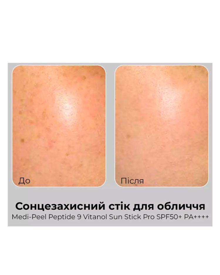 Сонцезахисний стік MediPeel Peptide 9 Vitanol Sun Stick Pro SPF50+ PA++++, 30 мл - Зображення 3
