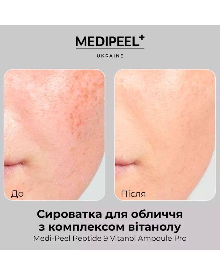 Сироватка антивікова освітлююча з 20% ніацинаміду - Medi-Peel Peptide 9 Vitanol Ampoule Pro 30 мл - Зображення 2