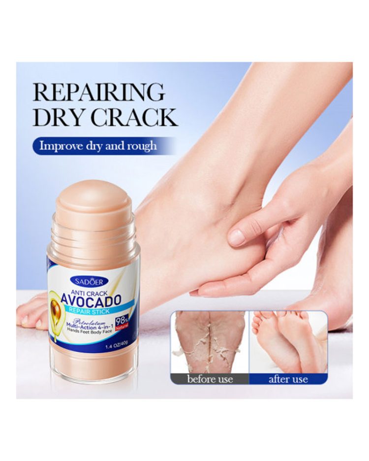 Стік з авокадо проти тріщин і сухості шкіри Sadoer Anti Crack Avocado Repair Stick, 40г